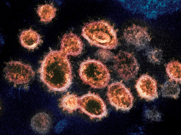 Novel Coronavirus SARS-CoV-2 This transmission electron microscope image shows SARS-CoV-2, the virus that causes COVID-19, isolated from a patient in the U.S. Virus particles are shown emerging from the surface of cells cultured in the lab. The spikes on the outer edge of the virus particles give coronaviruses their name, crown-like. Credit: NIAID-RML
